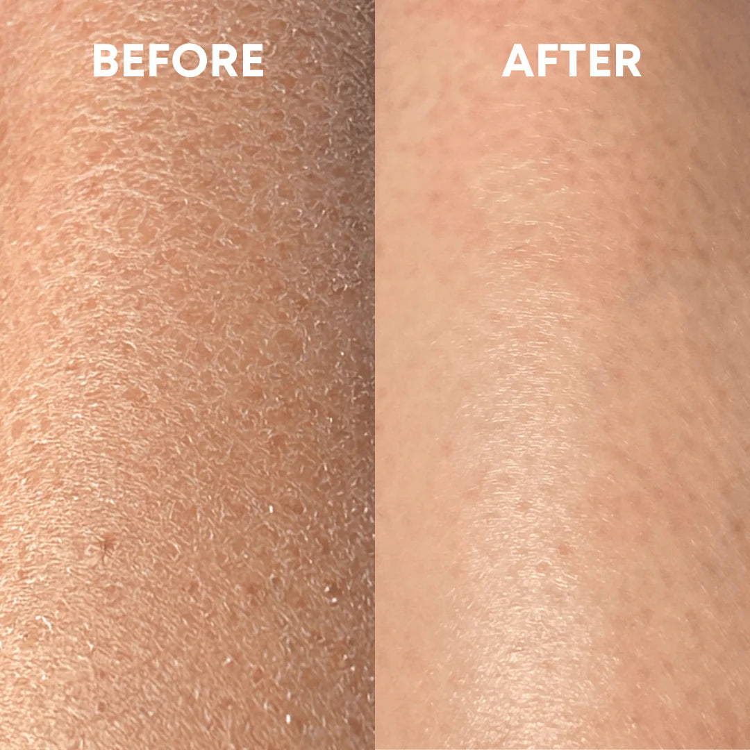 Silky Scrub - #1 Viral Exfoliating Glove